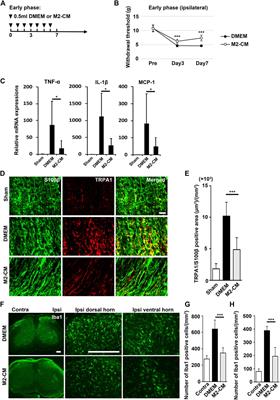 Conditioned Medium From the Stem Cells of Human Exfoliated Deciduous Teeth Ameliorates Neuropathic Pain in a Partial Sciatic Nerve Ligation Model